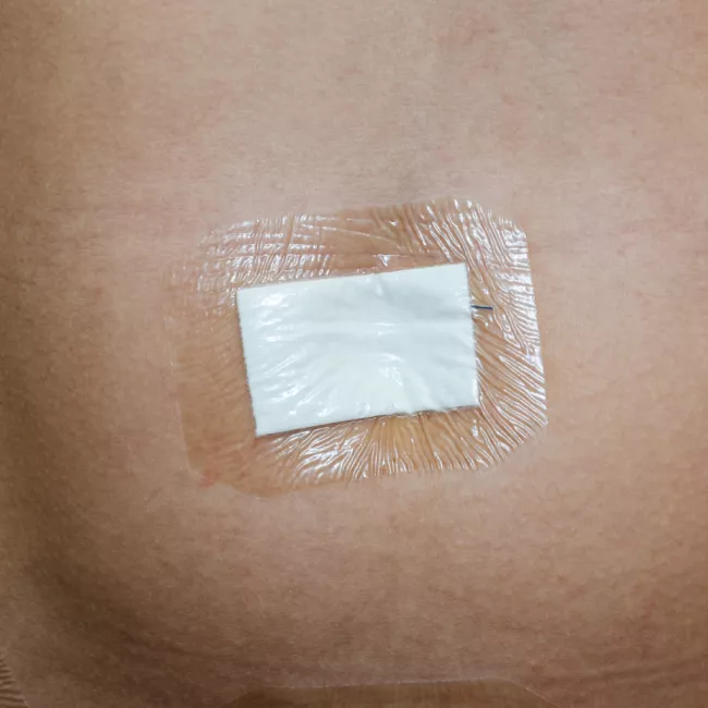 Transparent Film Dressings - Image 2